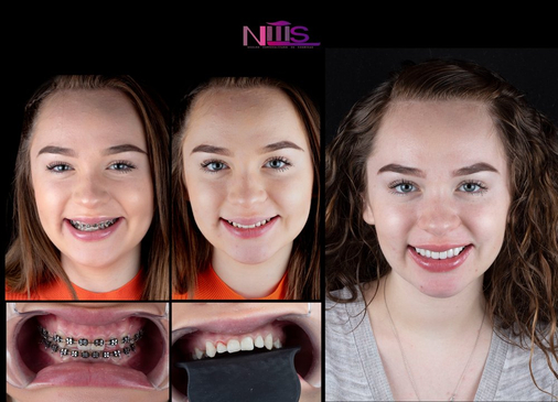 Slider image (6) NES Dental Clinic